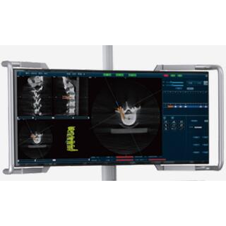 Surgical Navigation System PL300B image 4