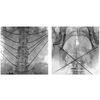 Surgical Navigation System PL300B image 13