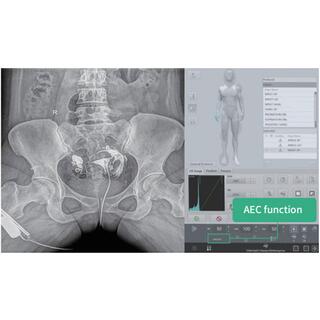 Dynamic FPD Digital Radiography & Fluoroscopy System PLD9600 Series image 20