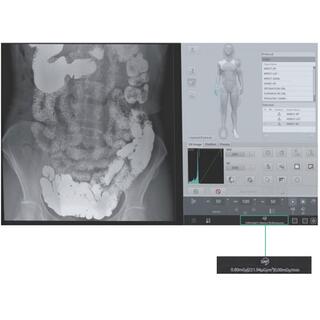 Dynamic FPD Digital Radiography & Fluoroscopy System PLD9600 Series image 21