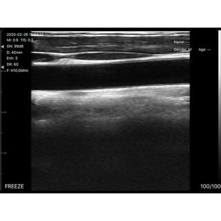 5CPL 3 in 1 Palm Doppler Ultrasound image 10