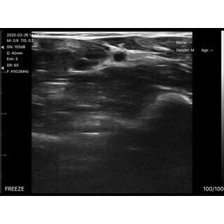 5CPL 3 in 1 Palm Doppler Ultrasound image 11