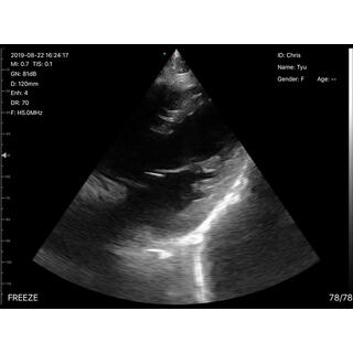 5CPL 3 in 1 Palm Doppler Ultrasound image 13