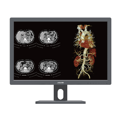 CR240G 2MP Clinical Review Monitor image 1