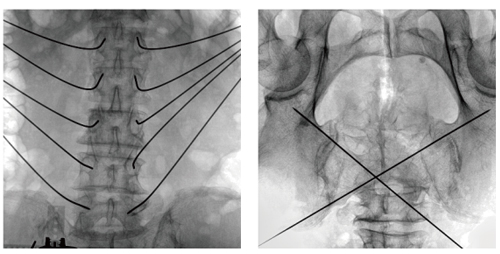 Surgical Navigation System PL300B image 13