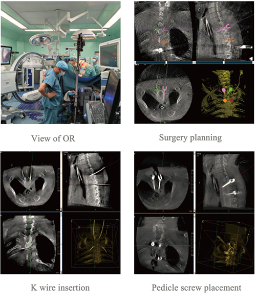 Surgical Navigation System PL300B image 14