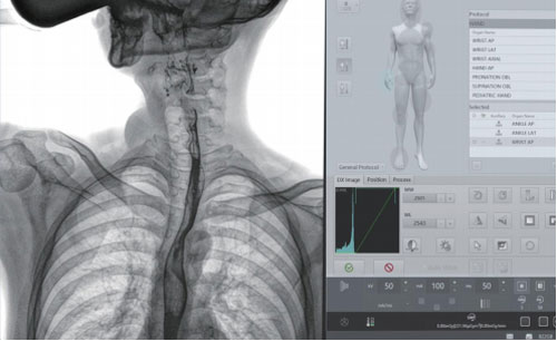 Dynamic FPD Digital Radiography & Fluoroscopy System PLD9600 Series image 23