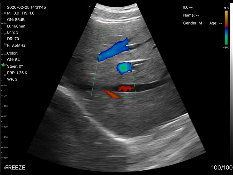 5CPL 3 in 1 Palm Doppler Ultrasound image 9