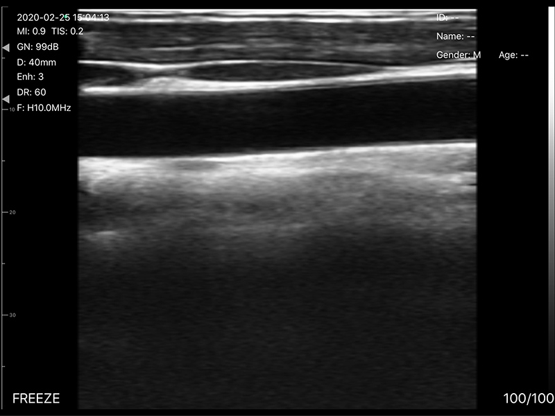 5CPL 3 in 1 Palm Doppler Ultrasound image 10