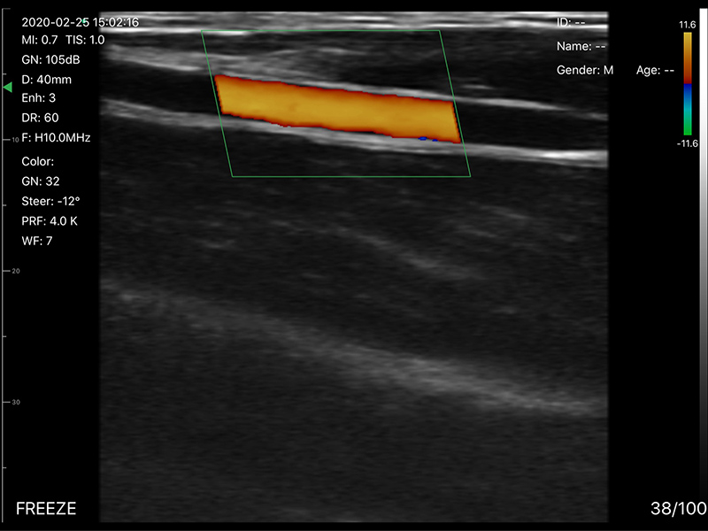 5CPL 3 in 1 Palm Doppler Ultrasound image 12