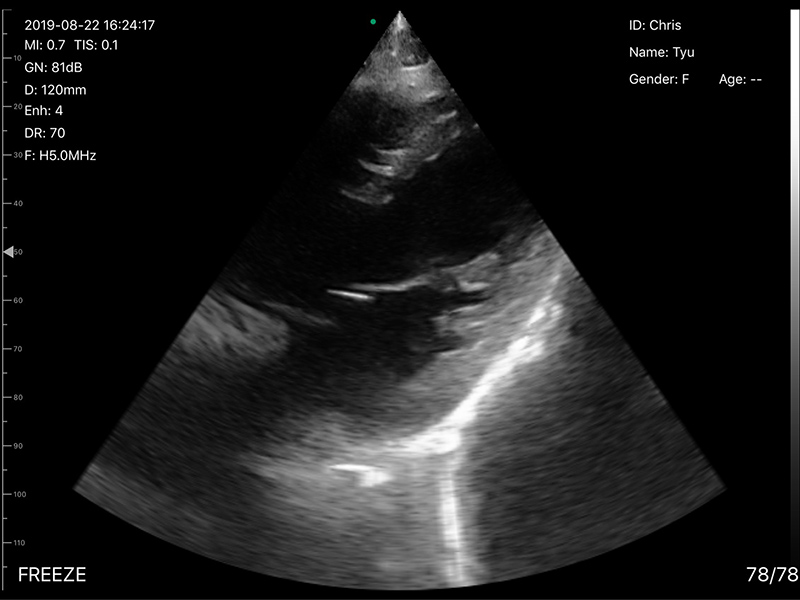 5CPL 3 in 1 Palm Doppler Ultrasound image 13