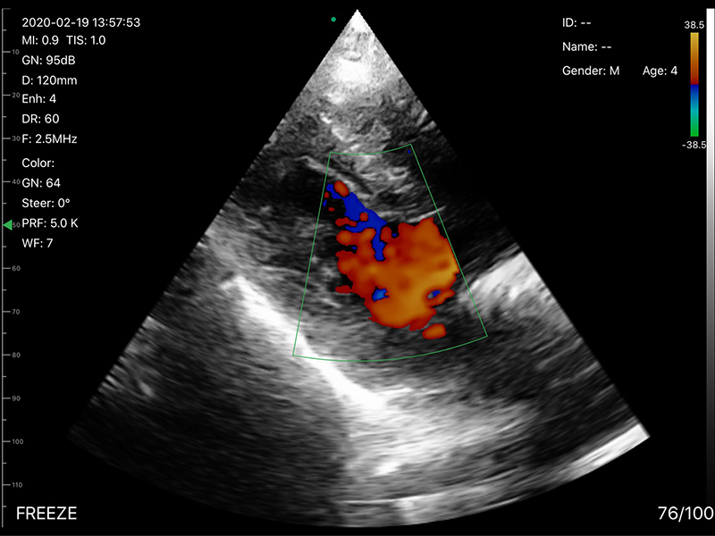 5CPL 3 in 1 Palm Doppler Ultrasound image 14